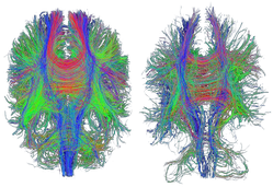 Concussion injury on a microscopic scale