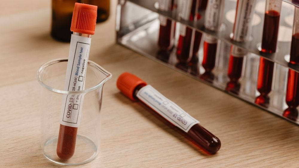 New cutting-edge concussion tests