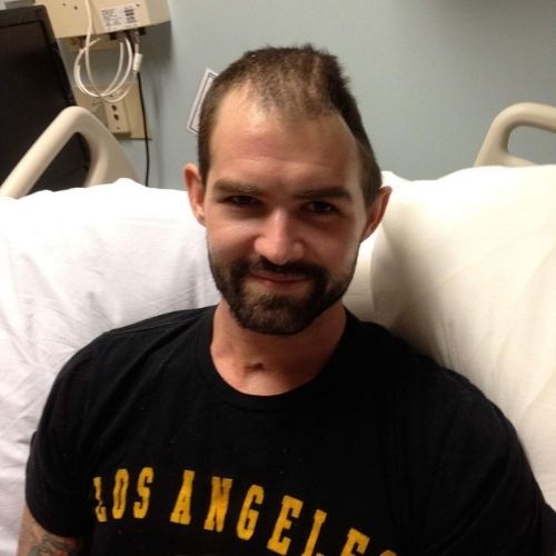 Traumatic brain injury symptoms James