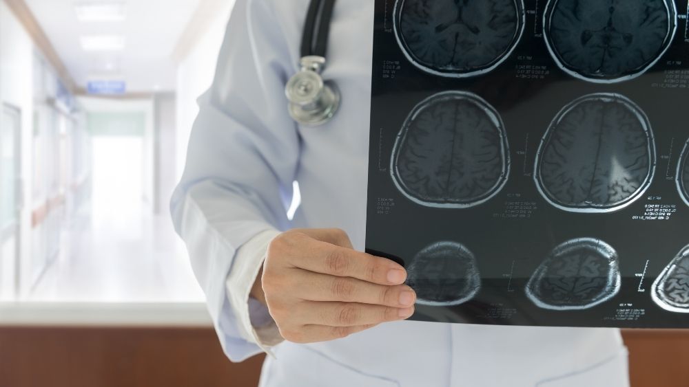 Medical professionals and post-concussion recovery